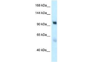 WB Suggested Anti-EDEM3 Antibody Titration: 1. (EDEM3 抗体  (C-Term))