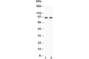 Western blot testing of Cadherin 17 antibody and Lane 1:  HeLa;  2: SW620 lysate (LI Cadherin 抗体  (AA 686-699))