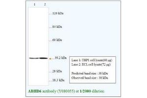 Image no. 1 for anti-Abhydrolase Domain Containing 6 (ABHD6) antibody (ABIN791375) (ABHD6 抗体)