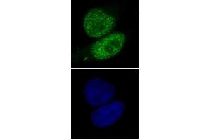 SMARCA4 antibody (mAb) (Clone 5B7) tested by immunofluorescence. (SMARCA4 抗体  (AA 213-295))