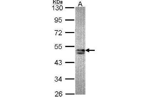 WB Image Sample (30 ug of whole cell lysate) A: A549 10% SDS PAGE antibody diluted at 1:1000 (SNX15 抗体  (C-Term))