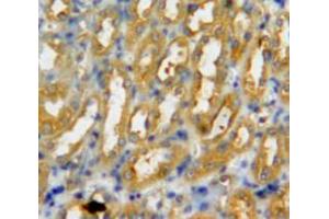 Used in DAB staining on fromalin fixed paraffin-embedded kidney tissue (PADI3 抗体  (AA 1-300))
