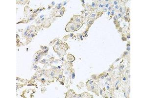 Immunohistochemistry of paraffin-embedded Human lung using MMRN1 Polyclonal Antibody at dilution of 1:100 (40x lens). (Multimerin 1 抗体)
