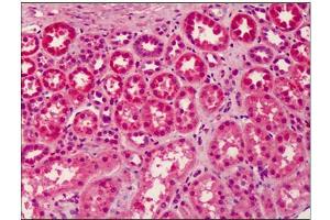 Human Kidney: Formalin-Fixed, Paraffin-Embedded (FFPE) (LGI3 抗体  (Center))