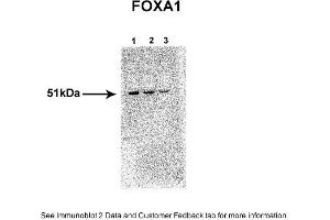 Sample Type: 1. (FOXA1 抗体  (N-Term))