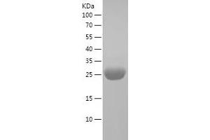 UCHL1 Protein (AA 1-220) (His tag)