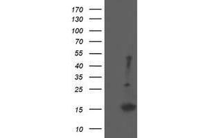 Image no. 3 for anti-Eukaryotic Translation Initiation Factor 5A2 (EIF5A2) antibody (ABIN1497997) (EIF5A2 抗体)