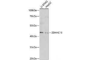 Western blot analysis of extracts of various cell lines using ZDHHC15 Polyclonal Antibody at dilution of 1:1000. (ZDHHC15 抗体)
