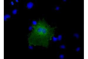 Anti-CBWD1 mouse monoclonal antibody (ABIN2452883) immunofluorescent staining of COS7 cells transiently transfected by pCMV6-ENTRY CBWD1 (RC222790). (CBWD1 抗体)