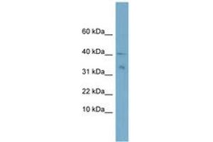 Image no. 1 for anti-NADH Dehydrogenase (Ubiquinone) Flavoprotein 3, 10kDa (NDUFV3) (C-Term) antibody (ABIN6743390) (NDUFV3 抗体  (C-Term))