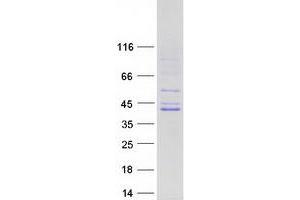 Western Blotting (WB) image for Muscleblind-like Protein 1 (MBNL1) (Transcript Variant 5) protein (Myc-DYKDDDDK Tag) (ABIN2725581)
