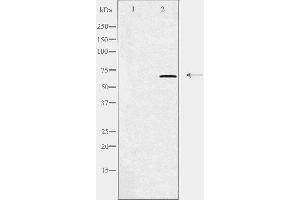 Western blot analysis of extracts from HUVEC cells using GRK5 antibody. (GRK5 抗体  (Internal Region))