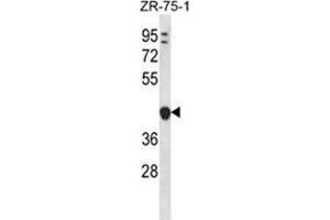 YIPF1 Antibody (N-term) western blot analysis in ZR-75-1 cell line lysates (35 µg/lane). (YIPF1 抗体  (N-Term))