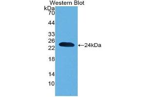 Western Blotting (WB) image for anti-Parkinson Protein 7 (PARK7) (AA 1-189) antibody (ABIN1078423) (PARK7/DJ1 抗体  (AA 1-189))