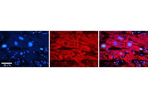 Rabbit Anti-MAOB Antibody   Formalin Fixed Paraffin Embedded Tissue: Human heart Tissue Observed Staining: Cytoplasmic Primary Antibody Concentration: 1:100 Other Working Concentrations: N/A Secondary Antibody: Donkey anti-Rabbit-Cy3 Secondary Antibody Concentration: 1:200 Magnification: 20X Exposure Time: 0.