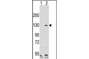 Western blot analysis of RP1 (arrow) using rabbit polyclonal RP1 Antibody (N-term) (ABIN390353 and ABIN2840765). (PARP1 抗体  (N-Term))