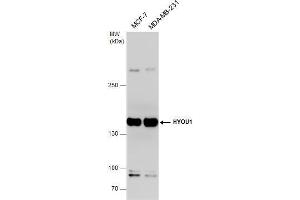 WB Image HYOU1 antibody detects HYOU1 protein by western blot analysis. (HYOU1 抗体  (C-Term))