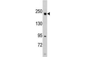Western blot analysis of anti-RICTOR Pab in SK-BR-3 cell line lysates (35 µg/lane).