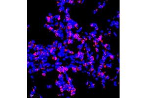 Immunofluorescence of paraffin embedded rat lung using P4H (ABIN7074215) at dilution of 1:700 (400x lens) (HIF Prolyl Hydroxylase 抗体)