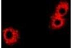 Immunofluorescent analysis of PHPT1 staining in Hela cells. (PHPT1 抗体)