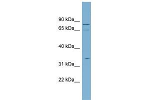WB Suggested Anti-SLC5A9 Antibody Titration:  0. (SLC5A9 抗体  (N-Term))