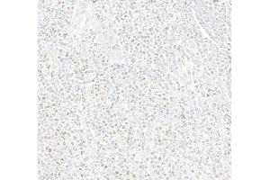 Immunohistochemistry (IHC) image for anti-Myocyte Enhancer Factor 2C (MEF2C) (AA 425-475) antibody (ABIN7795747) (Recombinant MEF2C 抗体  (AA 425-475))
