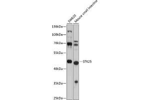 Western blot analysis of extracts of various cell lines, using STK25 antibody (ABIN6132842, ABIN6148604, ABIN6148605 and ABIN6225078) at 1:1000 dilution. (STK25 抗体  (AA 297-426))