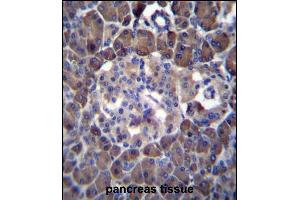 MLM Antibody (C-term) (ABIN6242125 and ABIN6577331) immunohistochemistry analysis in formalin fixed and paraffin embedded human pancreas tissue followed by peroxidase conjugation of the secondary antibody and DAB staining. (Cutaneous Malignant Melanoma/dysplastic Nevus 抗体  (C-Term))