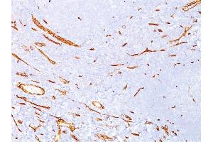 Formalin-fixed, paraffin-embedded human tonsil stained with CD34 Mouse Monoclonal Antibody (QBEnd/10). (CD34 抗体)