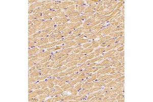 Immunohistochemistry of paraffin embedded rat heart using MYL6 (ABIN7074734) at dilution of 1:650 (400x lens)