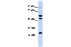 Image no. 1 for anti-Zinc Finger Protein 200 (ZNF200) (AA 324-373) antibody (ABIN6742764) (ZNF200 抗体  (AA 324-373))