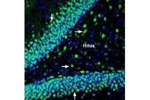 Immunohistochemistry (IHC) image for anti-Solute Carrier Family 9 (Sodium/hydrogen Exchanger), Member 6 (SLC9A6) (AA 515-528), (Intracellular) antibody (ABIN7043760)