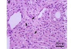 Immunohistochemistry (IHC) image for anti-CD177 Molecule (CD177) (AA 521-650) antibody (ABIN687187)