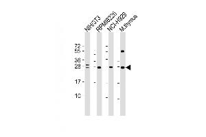 All lanes : Anti-FGFR1OP2 Antibody at 1:4000 dilution Lane 1: NIH/3T3 whole cell lysate Lane 2: R whole cell lysate Lane 3: NCI- whole cell lysate Lane 4: mouse thymus lysate Lysates/proteins at 20 μg per lane. (FGFR1OP2 抗体  (AA 1-172))