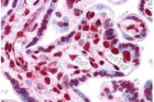 Human Placenta: Formalin-Fixed, Paraffin-Embedded (FFPE) (HMGB1 抗体  (AA 1-91))