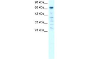 Western Blotting (WB) image for anti-Poly (ADP-Ribose) Polymerase Family, Member 3 (PARP3) antibody (ABIN2460803) (PARP3 抗体)