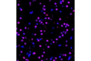 Immunofluorescent analysis of paraffin embedded mouse brain using MED8 (ABIN7074582) at dilution of 1: 600 (MED8 抗体)