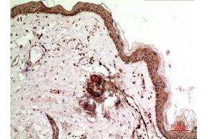 Immunohistochemistry (IHC) analysis of paraffin-embedded Human Skin, antibody was diluted at 1:100. (Synovial Sarcoma, X Breakpoint 2B (SSX2B) (C-Term) 抗体)