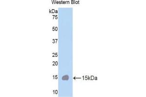 Western blot analysis of the recombinant protein. (CUBN 抗体  (AA 3511-3623))