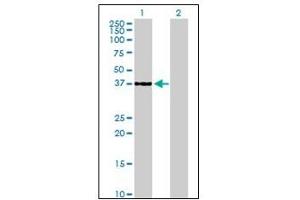 Western Blotting (WB) image for anti-Cyclin-Dependent Kinase 6 (CDK6) antibody (ABIN781963) (CDK6 抗体)