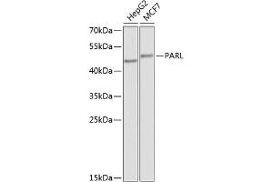 Western blot analysis of extracts of various cell lines, using PARL antibody (ABIN6132564, ABIN6145228, ABIN6145229 and ABIN6224252) at 1:1000 dilution. (PARL 抗体  (AA 1-170))