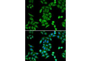 Immunofluorescence analysis of MCF-7 cells using RBPJ antibody. (RBPJ 抗体)
