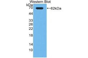 Western blot analysis of the recombinant protein. (PIK3C2A 抗体  (AA 349-611))