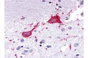 Immunohistochemical staining of Brain (Neurons and glia) using anti- KISS1R antibody ABIN122164 (KISS1R 抗体  (Cytoplasmic Domain))