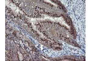 Image no. 11 for anti-Diphthamide Biosynthesis Protein 2 (DPH2) antibody (ABIN1497893)