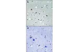 Immunohistochemical staining of human brain tissue by LATS1/LATS2 (phospho T1079/1041) polyclonal antibody  without blocking peptide (A) or preincubated with blocking peptide (B) under 1:50-1:100 dilution.