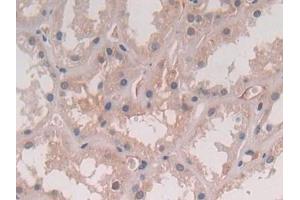 DAB staining on IHC-P; Samples: Human Kidney Tissue (IL-5 抗体  (AA 20-134))