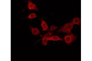 Immunofluorescence (fixed cells) (IF/ICC) image for anti-ATP-Binding Cassette, Sub-Family D (Ald), Member 1 (ABCD1) (Internal Region) antibody (ABIN6257662)