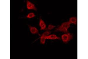 ABIN6274884 staining Hela by IF/ICC. (ABCD1 抗体  (Internal Region))