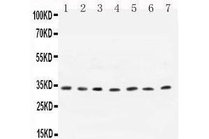 Anti- Cyclin D1 antibody,  All Western blotting All lanes: Anti-CCND1() at 0. (Cyclin D1 抗体  (C-Term))